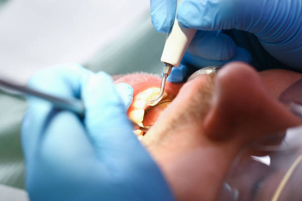 Best Emergency Care for Gum Disease in Wallingford Center, CT
